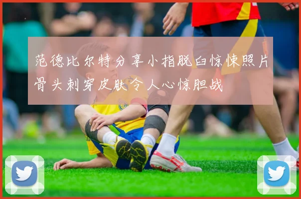 范德比尔特分享小指脱臼惊悚照片骨头刺穿皮肤令人心惊胆战